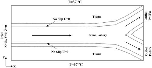 Figure 3. Thermal and fluid Boundary conditions.
