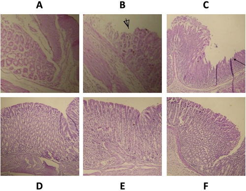 Figure 3 Histological section of mice stomach showing healing effects of Pseudocedrela kotschyi and Ximenia americana on hydrochloric acid (0.3 M)/ethanol (60%)-induced ulcer (40×; H & E staining). Normal gastric mucosa was observed in distilled water treated (negative control, (A)). In hydrochloride acid-challenged groups, ulcerative lesions of the gastric mucosa (⍋) were seen in a positive control (B), partial healing mucosa (←) in lansoprazole-treated (C); regenerative mucosa were retrieved in group treated with X. americana extract (D), regenerated inflammatory mucosa in P. kotschyi-treated (E) and by both plant extracts-treated group (F).