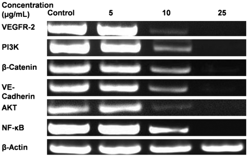 Fig. 5. Representative RT-PCR Analysis for VEGFR-2, PI3 K, β-Catenin, VE-Cadherin, Akt, and NF-kB.Notes: HUVECs were seeded in T-25 flasks at a density of 1.25 × 105 cells per flask. The 70% confluent cells were treated with 5−25 μg/mL of TSE1 for 48 h. Total RNA was extracted by the TRI reagent, and the expression level of the gene was analyzed by RT-PCR, using a gene-specific primer. β-Actin was taken as the input.