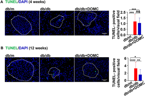 Figure 5 DOMC alleviated pancreatic β-cell apoptosis. (A) TUNEL staining of the pancreas slices after a 4-week experiment. (B) TUNEL staining of the pancreas slices after a 12-week experiment. White dotted boxes were depicted as pancreas islets, the number of TUNEL-positive cells was counted as green fluorescence cells in the boxes. The data were presented as means ± SD; n=6-14/group. *p<0.05, **p<0.005, ****p<0.0001. Scale bar: 50 μm.