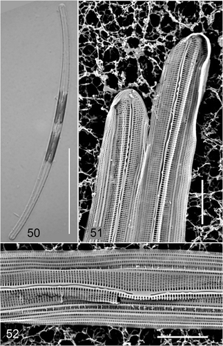 Figs 50–52. Climaconeis guamensis from GU54A-F. Fig. 50. Live cell. Figs 51–52. SEM from whole mount of same material. Scale bars: Fig. 50 = 50 µm; Figs 51–52 = 5 µm.