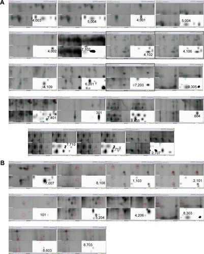 Figure S1 Selected protein spots for PMF analysis according to selection criteria.Notes: (A) Nineteen spots were increased and (B) ten spots were decreased by exposure to PbS–MPA QDs.Abbreviations: PMF, peptide map fingerprint; PbS–MPA QDs, lead sulfide–3-mercaptopropionic acid quantum dots.