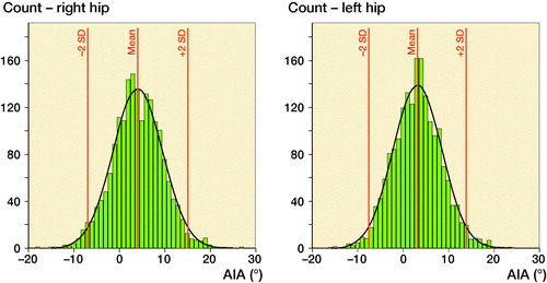 Figure 4. Distribution of the right and left AIA in 1,870 adults. For right hips, the mean AIA was 4.1 (SD 5.5) and the range of 2 SDs –6.9 to 15.0. For left hips, the mean AIA was 3.2 (SD 5.4) and the range of 2 SDs –7.7 to 13.9.