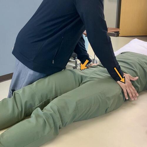 Figure 6 Distraction Test – With the patient supine, the clinician applies a downward and lateral force, away from midline, through the patient’s ASIS as depicted by the two arrows.