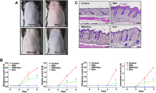 Figure 1 Dun treatment ameliorates IMQ-induced skin lesions in C57BL/6 mice. (A) Mouse model of psoriasis induced in mice by topical application of IMQ. Psoriasis-like skin lesions were observed after 6 days in IMQ-treated animals, but animals treated with 80 mg/kg Dun exhibited attenuated symptoms. (B) Erythema, scaling, and thickness of dorsal skin was scored on the indicated days. The cumulative score (erythema plus scaling plus thickness) is presented. Symbols indicate the mean ± S.D. (n = 5). (C) Phenotypical presentation and corresponding histology (H&E staining) of mouse dorsal skin. *p < 0.05 vs the IMQ group.