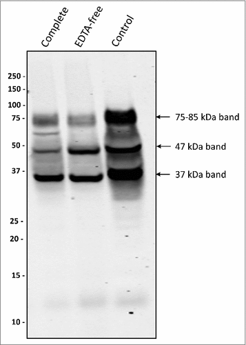 Figure 4. Protease inhibitors suppress the formation of a 75–85-kDa PPAD species P. gingivalis sorting type II isolate 20663 was grown in the presence or absence of protease inhibitors as indicated. Growth medium fractions, containing OMVs, were analyzed by immunoblotting as indicated for Figure 1. Molecular weights of marker proteins and different PPAD species are indicated.