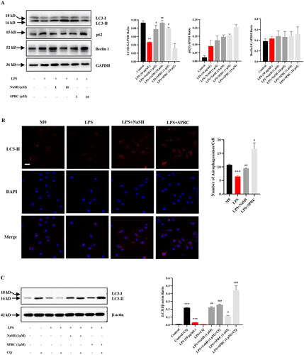 Figure 5. The autophagy is activated by H2S donors in LPS-treated RAW264.7 cells. (A) RAW264.7 cells were treated with or without NaSH and SPRC (1, 10 μM) for 24 h, western blot was used to examine the expression of LC3, p62 and Beclin 1. (B) Cells were stained with anti-LC3 antibody to observe autophagosome formation and analyzed by DeltaVision Ultra. At least 30 cells were counted for each treatment. Scale bar, 20 μm. (C) CQ was used to examine autophagic flux. Data are represented as Mean ± SD. All experiments were repeated triplicate. *p < 0.05, **p < 0.01, ***p < 0.001 vs. M0; #p < 0.05, ##p < 0.01, ###p < 0.001 vs. LPS.