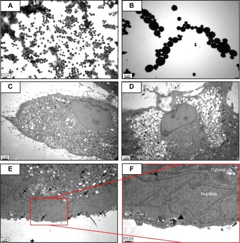 Figure 2 Transmission electron microscopy of different sized particles and observation of treated cells.Notes: (A) NP and (B) MP media were observed by transmission electron microscopy. Adipose tissue-derived stem cells were incubated in each type of medium for 24 hours and then observed by transmission electron microscopy. Representative images are shown for (C) untreated cells, (D) silica MP-treated cells, and (E, F) silica NP-treated cells. Black arrows indicate particles and the triangle indicates a vesicle.Abbreviations: NP, nanoparticle; MP, microparticle.