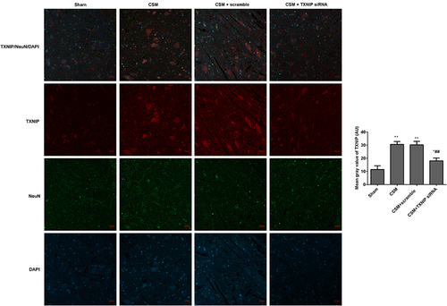 Figure 6 Inhibition of TXNIP declined the TXNIP expression in the anterior horn of the lesioned area following CSM. The mean fluorescence intensities of TXNIP/NeuN were analyzed by immunofluorescence. The mean gray values were analyzed using Image J software. Compared with the sham group, *P<0.05, **P<0.01; compared with the scrambled group, ##P<0.01.