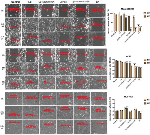 Figure 7 Representative images of the migratory capacity of the breast adenocarcinoma (MDA-MB-231, MCF7) cells and breast epithelial (MCF 10A) cells after treatment with test compounds at concentration of 25 µM. The results were expressed as percentage of wound closure after 24 h (normothermia/hyperthermia) compared to the initial surface; NT – normothermia (37 °C), HT – hyperthermia (43 °C). The cells were visualized by light microscopy, at magnification 20x. Scale bars represent 50 µm. One-way ANOVA analysis was applied to determine the statistical differences followed by Tukey’s multiple comparisons test vs hyperthermia control (*p < 0.05; **p < 0.01; ***p < 0.001, ****p < 0.0001). The data represent the mean values ± SD of three independent experiments (n=3).