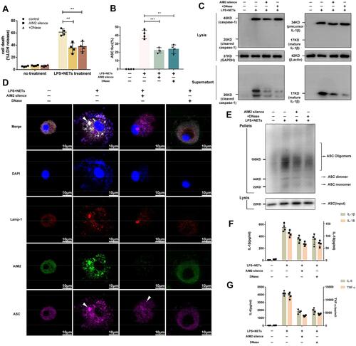 Figure 6 Silencing of the AIM2 gene or degradation of NET DNA alleviates alveolar macrophage pyroptosis. Silencing of the AIM2 gene or degradation of NET DNA decreased (A) LDH release, (B and D) intracellular pyroptosome formation, (C) cleaved caspase-1 and IL-1β production and (E) ASC oligomerization. Administration of AIM2 siRNA and degradation of NET DNA also reduced (F) IL-1β, IL-18, and (G) IL-6 and TNF-ɑ levels in the supernatant. (**p<0.01, ****p<0.0001).