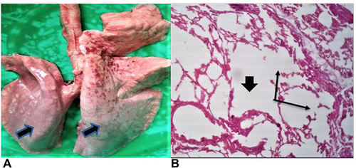 Figure 5 Lung with air inflated areas (A). Histologic section showing giant alveoli (wide arrow) accompanied by destruction of alveolar walls (long arrows) H&E ×10 (B).