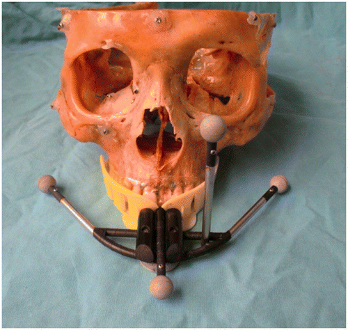 Figure 4. The skull fitted with the device.