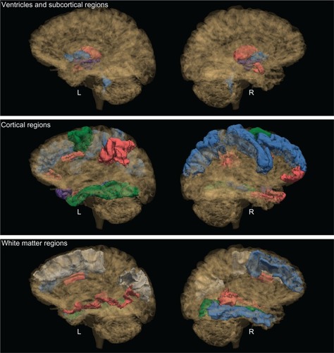 Figure 1 Significant group contrasts for brain regions.