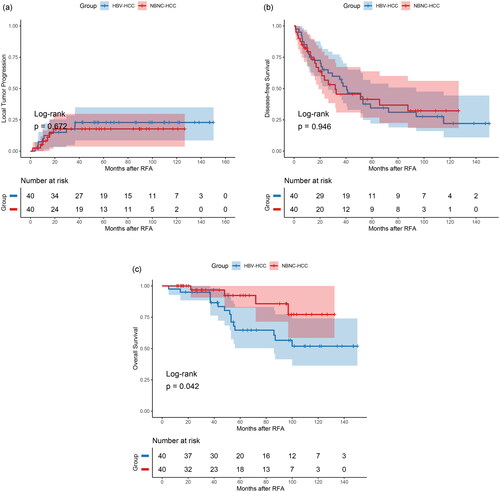 Figure 3. Comparisons of local tumor progression (A), disease-free survival (B), and overall survival (C) after RFA among the NBNC-HCC and HBV-HCC groups after propensity score matching. HBV-HCC: hepatitis B virus (HBV)-related hepatocellular carcinoma; NBNC-HCC: non-B non-C hepatocellular carcinoma; RFA: radiofrequency ablation.