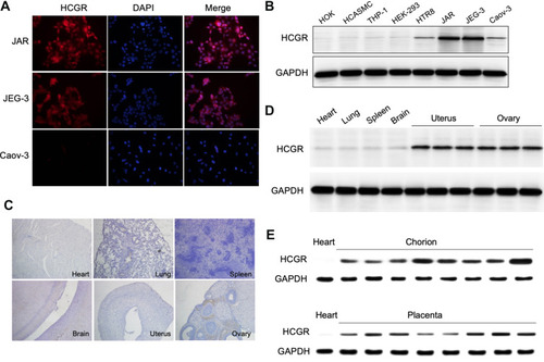 Figure 1 Expression levels of HCGR protein. (A) Cancer cells were stained with anti-HCGR (red) antibody, and cell nuclei were stained with DAPI (blue). Confocal images were collected to analyze the HCGR protein expression on human genital system cancer cell lines. (B) HCGR expression in a panel of human cell lines were examined using Western blot experiment. (C) HCGR expression were detected in the heart, lung, spleen, brain, uterus and ovary of BALB/c mice via immunohistochemistry staining. (D) Western blot assay presented the expression levels of HCGR in different tissues of BALB/c mice. (E) HCGR expression level were evaluated in a cohort of human clinical specimens.