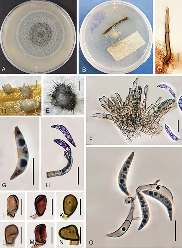 Figure 5. Colletotrichum nicholsonii (from strain UTFC 366). A. Colony on OA after 7 d. B. Colony on SNA amended with a double autoclaved stem of Anthriscus sylvestris and autoclaved filter paper. C. Seta. D, E. Acervuli. F, H. Conidiophores. G, O. Conidia. I–N. Appressoria. C, D. from Anthriscus stem. E. from autoclaved filter paper. F–O. from SNA. D–E. DM. C, F–O. DIC. Scale bars: D–E = 50 μm, C, F–O = 10 μm.