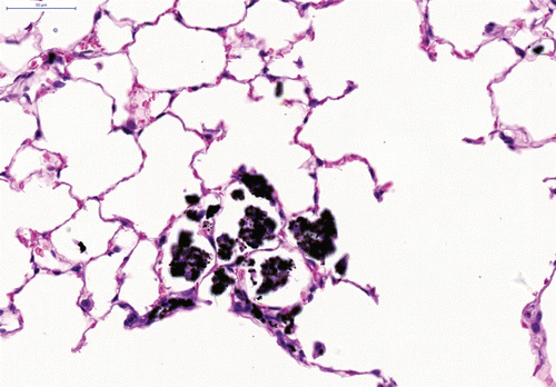 Figure 5.  Slight multifocal intra-alveolar and interstitial accumulation of particle-laden macrophages associated with only minimal interstitial inflammatory cell infiltration after repeated intratracheal instillation of fine coal dust. H&E × 200.