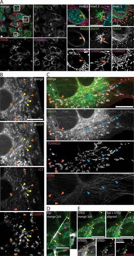 Figure 3. 1-Deoxysphingolipids induce various cellular lipid aggregates. MEF cells were treated with (A) 1 μM alkyne doxSA or (B-E) 1 μM doxSA mix (0.9 μM doxSA + 0.1 μM alkyne doxSA tracer) for 24 h. After fixation cells were probed for various organelle markers by immunofluorescence and the alkyne moiety was reacted with ASTM-BODIPY (A) or N3635P-reporter (B–E). Micrographs were recorded using structured illumination (A,D) or STED (B,C,E) microscopy. (A) Maximum image projections of z-stacks after deconvolution depict alkyne lipids (green, doxSA), nuclei (cyan, DAPI, merge+insets), mitochondria (magenta, TOMM20), endoplasmic reticulum (red, P4HB, merge) as color-merged or grayscale images. Note the lipid aggregates (insets, orange arrowheads). (B,C) Single-layer super-resolution micrographs depict lysosomes (red, LAMP1), autophagosomes (magenta, LC3), and TUBB (red) as color-merged or grayscale images. Other channel colors are as above. Note the straight hollow profiles of lipid aggregates (orange arrowheads) distinguishable from filled crystal-like structures (blue arrowheads) both positive for alkyne lipids. Also note the autophagosomal structures positive for LC3-II and LAMP1 neighboring the lipid aggregates (yellow arrowheads). (D,E) Correlative Epifluorescence and STED microscopy images showing the same cell as (D) maximum image projection of a z-stack with side views at the indicated positions (open triangles) including the polarized light channel (gray), and (E) as a single-layer super-resolution image with superimposed birefringent crystal (dashed line), aligned using the 3 marked lysosomes (yellow arrowheads) as landmarks. Note the straight crystal-like structure (blue arrowhead), but not the lipid aggregate (orange arrowhead) exhibits birefringency. Bars, 10 μm