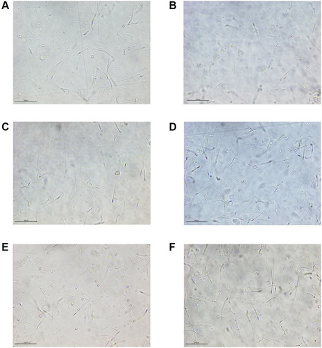Figure 18 The sperm morphology (×400). (A) The normal control group. (B) The model control group. (C) The low-dose CSMFCH group. (D) The medium-dose CSMFCH group. (E) The high-dose CSMFCH group. (F) The kaempferol group. Data: n = 6, experiments performed in triplicate.