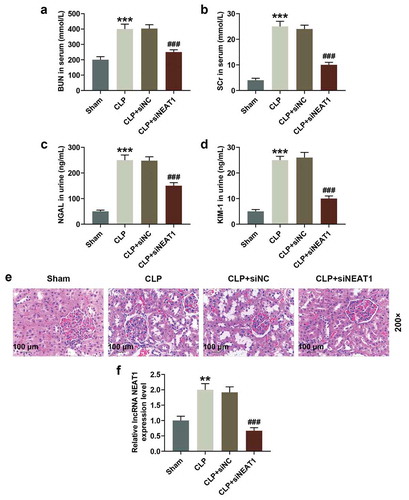 Figure 1. siNEAT1 alleviated kidney injury and improved kidney function in CLP-induced rats. a. BUN value in serum was assayed via colorimetric method. b. SCr value in serum was tested through colorimetric method. c. NGAL level in urine was determined. d. KIM-1 level in urine was detected. e. Kidney histological changes were evaluated by hematoxylin eosin staining. f. qPCR analyzed the expression of NEAT1. *P or #P < 0.05; **P or ##P < 0.01; ***P or ###P < 0.001, * vs. Sham; # vs. CLP+siNC (BUN: Blood urea nitrogen; SCr: serum creatinine; CLP+siNC: After CLP modeling for 0.5 h, rats were transfected with negative control siRNA (siNC); CLP+siNEAT1: After CLP modeling for 0.5 h, rats were transfected with siRNA-NEAT1).
