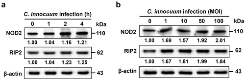 Figure 1. C. innocuum induces nucleotide-binding oligomerization domain containing 2 (NOD2) and receptor-interacting protein 2 (RIP2) expression. HT-29 cells were infected with C. innocuum at (A) multiplicity of infection (MOI) of 100 for 0–4 h, and (B) MOI of 0–100 for 4 h. Expression levels of NOD2 and RIP2 were determined using western blotting. The protein expression levels of NOD2 and RIP2 were quantified by densitometric analysis and normalized to β-actin level, respectively, and indicated at the bottom of each lane.