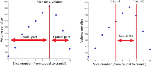 Figure 2. Volume of the slices composing a parotid gland: Illustration of the superior-inferior extension of caudal, cranial parts and SCC region.