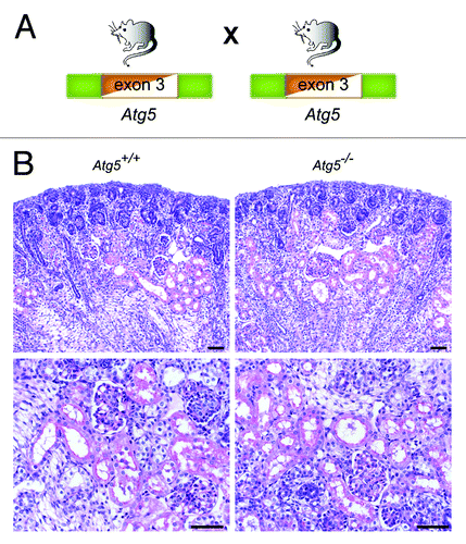 Figure 2. There is no detectable abnormality in Atg5−/− kidneys at E19.5. (A) Atg5+/− mice, missing exon 3 constitutively in one Atg5 allele, were bred to generate Atg5−/− mice. (B) No obvious histological alterations can be detected in Atg5−/− mice at E19.5. Scale bars: 50 µm.