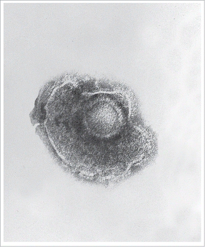 Figure 1. Transmission electron microscopic (TEM) image of a VZV particle (CDC/ Dr Erskine Palmer and B.G. Partin).