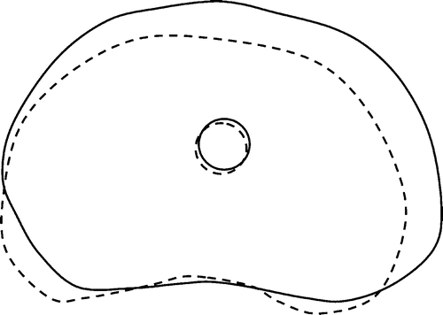 Figure 6. Contours of the prostate cross-section and the urethral warmer location for prostate model B, using 14 cryoprobes in Stage I and 7 cryoprobes in Stage II: l1 = 32 mm (solid line) and l2 = 15 mm (dashed line).