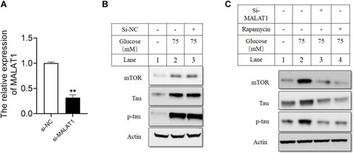 Figure 2 Silencing of MALAT1 attenuated the effects of HG on the levels of mTOR, tau and p-tau in hippocampus cells. (A) The relative expression of MALAT1 was detected by qRT-PCR in hippocampus cells transfected with si-NC or si-MALAT1. (B and C) Hippocampus cells were transfected with si-NC or si-MALAT1, or treated with rapamycin, and 24 h later the cells were treated with HG (75 mM) for 24 h, and protein levels of mTOR, tau and p-tau were determined by Western blot assay. N = 3; ** p < 0.01.