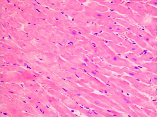 Fig. 3 Eosinophilic degeneration of wavy-directed cardiomyocytes with lack of stration (1DOX+GT, H+E, objective mag.×20).