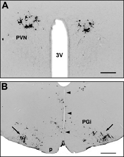 Figure 4 Midsagittal medullary transections. Bilateral distribution of viral infected cells (similar to unoperated rats) in the hypothalamic paraventricular nucleus (A) 5 days and (B) in the rostral medulla oblongata (arrows point to the dense populations of infected cells in the C1 cell group) 4 days after inoculation of the virus into the right hind limb. Abbreviations: p, pyramidal tract; PGi, paragigantocellular reticular nucleus; PVN, paraventricular nucleus; 3V, third ventricle. The arrowheads point to the mid-sagittal medullary transection (narrow vertical cut in the midline). Scale bars = 500 μm (A) and 1 mm (B).
