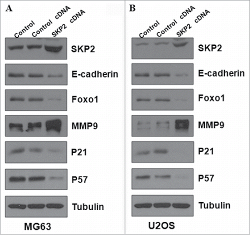 Figure 5. Overexpression of Skp2 regulated the related genes in OS cells. (A) The expression of downstream targets of Skp2 was detected by Western blotting in MG63 cells after Skp2 cDNA transfection. (B) Western blotting was performed to measure the expression of Skp2 downstream targets in U2OS cells with Skp2 overexpression.