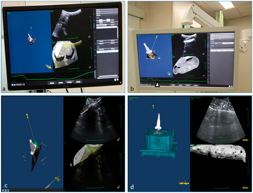 Figure 2. (a) and (b) showed the real-time multimodality imaging of the rabbit liver cancer model and the respiratory calibration curve (△). (c) and (d) showed the real-time multimodality imaging of the porcine liver tumor model.