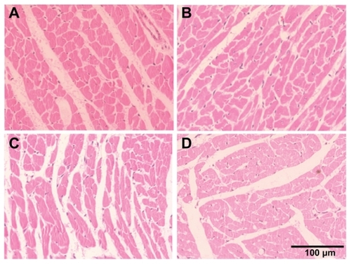 Figure 7 Cerium oxide nanoparticle exposure has no effect on histological appearance of heart. (A) saline control (400×), (B) CeO2 at 1.0 mg/kg (400×), (C) CeO2 3.5 mg/kg (400×), and (D) CeO2 7.0 mg/kg (400×).