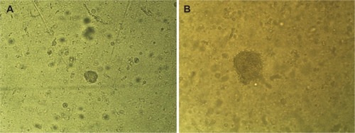 Figure 4 AMJ13 cells growing in an anchorage-independent fashion using soft agar colony assays.