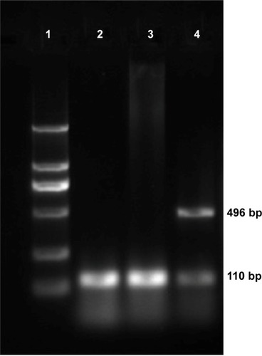 Figure 3 Gel electrophoresis of HSV-TK amplified by RT-PCR after pHsp 70-HSV-TK transfected into SMMC-7721 cells.Notes: Lane 1, marker (each band in turn from bottom to top is 100, 300, 500, 750, 1,000, and 2,000 bp); lane 2, infected cells that did not receive hyperthermia with only one strip, 110 bp of GAPDH; lane 3, untransfected SMMC-7721 cells with only one strip, 110 bp of GAPDH; lane 4, infected cells that receive hyperthermia with two clear strips, 496 bp of HSV-TK and 110 bp of GAPDH used as reference gene.Abbreviations: bp, base pair; GAPDH, glyceraldehyde 3-phosphate dehydrogenase; HSV-TK, herpes simplex virus thymidine kinase; RT-PCR, reverse transcription-polymerase chain reaction.