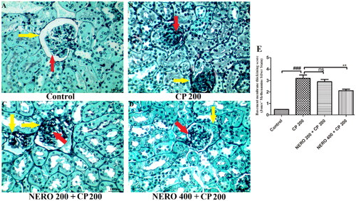 Figure 7. Showing the effect of nerolidol 200 and 400 mg/kg, p.o against cyclophosphamide-induced histopathological aberrations (JMS staining) in the renal tissue and figure E represents the semi-quantitative analysis basement membrane thickening score. One-way ANOVA i.e., tukey’s multiple comparison test was used for statistical analysis. (JMS staining, 400 × magnification).