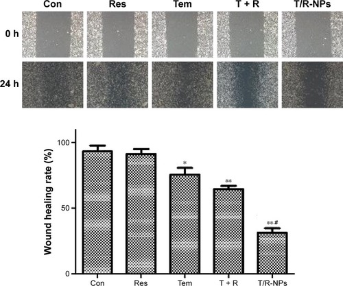 Figure 5 Wound healing assay of U87 cells when treated with T/R-NPs.Notes: *P<0.05 versus control group; **P<0.01 versus control group. #P<0.05 vs T + R group.Abbreviations: Con, control; Res, resveratrol; Tem, temozolomide; T/R-NPs, Tem/Res-coloaded nanoparticles; h, hours.