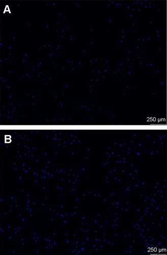 Figure 5 Fluorescence micrographs of osteoblasts (nuclei in blue) incubated on (A) Ti and (B) USP-Ti after 4 hours of culture.Abbreviations: Ti, titanium; USP-Ti, Ti surface subjected to USP; USP, ultrasonic shot peening.