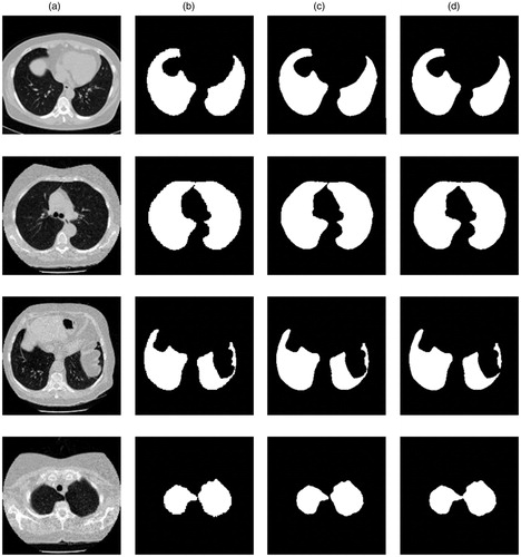 Figure 4. (a) is the original lung CT images. (b) is ground trues from the manual segmentation of a clinically experienced doctor. (c) is segmentation results from our network. (d) is segmentation results from U-net.