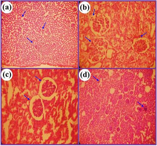 Figure 10. Photomicrograph of kidney tissues of rats for (a) control, (b) Cis group, (c) Cis + DC (400 mg/kg), and (d) Cis + DC (600 mg/kg)