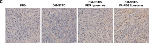 Figure 4 Anti-tumor study in H22 tumor-bearing mice.Notes: (A) Tumor growth in H22 tumor-bearing mice of DM-NCTD and DM-NCTD liposome groups after H22 cells were injected at day 0 (2 mg/kg per day, administered on days 1–9, and killed on day 10; n=10); (B) H22 tumor-bearing mice weight change of DM-NCTD and DM-NCTD liposome groups after H22 cells were injected at day 0 (2 mg/kg per day, administered on days 1–9, and killed on day 10; n=10); (C) tumors of H22 tumor-bearing mice stained with TUNEL after in vivo antineoplastic activity study (bar 20 μm). **P<0.01, *P<0.05 vs DM-NCTD group; ##P<0.01, #P<0.05 vs DM-NCTD/PEG liposome group.Abbreviations: DM, diacid metabolite; NCTD, norcantharidin; FA, folic acid; PEG, polyethylene glycol; PBS, phosphate-buffered saline; TUNEL, terminal deoxynucleotidyl transferase deoxyuridine triphosphate nick-end labeling.