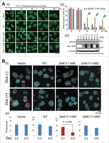 Figure 4. GAK-Y1149F cells show a delay in S phase progression. (A) (i) Typical IF images, obtained by immunostaining with an anti-RPA70 antibody, of HeLa S3 cells expressing the vector alone (Vector), GAK-WT, GAK-Y1149F, or GAK-Y1149D in the presence of Dox at the indicated number of hours after TDBR treatment. (ii) Bar graphs showing the frequency (%) of HeLa S3 cells harboring more than 20 RPA70 dot signals. Green arrowheads highlight that GAK-Y1149F-expressing cells showed an increased frequency of RPA70-positive cells at 6, 9, and 12 h after TDBR treatment. (iii) Wb analysis indicates that the RPA70 level was unaltered and that the GAK-WT, GAK-Y1149F, and GAK-Y1149D proteins were successfully induced in the presence of Dox. α-tubulin was detected as a loading control. Bar, 10 µm. (B) The amount of newly synthesized DNA was reduced in Dox (+) GAK-Y1149F cells. (i) Typical images of Vector, GAK-WT, GAK-Y1149F, or GAK-Y1149D cells after incorporation of fluorescently labeled EdU in the presence (+) or absence (−) of Dox. Bar, 200 µm. (ii) Bar graphs showing the frequency (%) of the indicated HeLa S3 cells harboring more than 20 EdU dot signals. The difference between (−) and (+) red bars is statistically significant (P = 0.008).