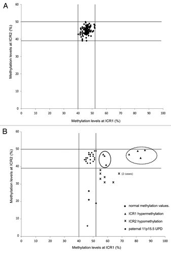 Figure 1. Distribution of ICR1 and ICR2 methylation values in the control population (A) and postnatal BWS cases (B). Vertical (ICR1) and horizontal (ICR2) lines define the threshold levels of normal methylation values. The cases (▲) with mild ICR1 hypermethylation associated with abdominal wall defects (umbilical hernia or diastasis recti), but not with omphalocele, are encircled by a solid line. The cases (▲) with severe ICR1 hypermethylation associated with macroglossia, macrosomia, and visceromegaly are encircled by a dotted line. Cases with ICR2 hypomethylation (♦). Cases with both ICR1 and ICR2 methylation anomalies, indicating UPD ()