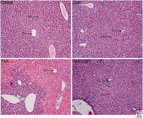 Figure 2. H&E staining of the liver (200×). The histopathology of control and DMY groups shows normal liver architecture. In TAA group, the liver shows a massive hepatocellular necrosis in some part of the liver; the necrosis is focal but not diffuse. In the TAA + DMY group, hepatocytes were hypertrophied with many cytoplasmic vacuoles and oedematous enlarged nuclei, indicating hepatocellular degeneration. Mild mononuclear infiltration was also observed around the central vein. Hepatocellular injury is clearly milder in the TAA + DMY than the TAA group. HC: hepatocytes; CV: central vein; VH: vacuolated hepatocytes.