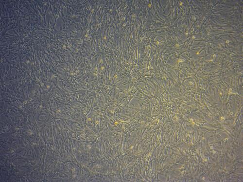 Figure 3 Cell culture of UCMSCs (Culture day 5th, passage 4, magnification 40x).