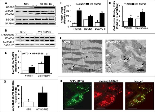 Figure 8. Overexpression of HSPB6 WT in the murine heart activates autophagic flux. (A), Representative immunoblots for determining the expression of HSPB6, LC3A/B-I/II and BECN1 in NTG and HSPB6 WT hearts; (B), Quantitative results of immunoblots: values are expressed as the mean ± SEM, n = 3 hearts for NTG and 3 hearts for HSPB6 WT, *: P < 0.05, vs NTG; (C), Quantification of autophagic flux by cadaverine dye-binding assay. Mice were i.p. injected with chloroquine (CQ) for 4 h and cadaverine dye-binding analysis showed that autophagy levels were significantly increased in HSPB6 WT hearts treated with both saline (Vehicle) and CQ, compared to NTG hearts; (D and E), Increased autophagy flux in HSPB6 WT hearts: (D), Representative western blots of LC3A/B-I and LC3A/B-II with CASQ1/2 as loading control; (E), Autophagic flux data expressed as the means ± SEM. n = 5 hearts for each group; *: P < 0.05, vs NTG-Vehicle; #: P < 0.05, vs. NTG-CQ; (F), Electron microscopy reveals autophagosomes in myocytes isolated from NTG and HSPB6 WT hearts. Black arrows: autophagosomes; (G), Quantitative results of the number of autophagosomes in NTG and HSPB6 WT cardiomyocytes. Ten fields from cardiomyocytes of 3 different hearts for each group were counted; (HSPB6 is colocalized with LC3A/B labeled autophagosome in neonatal rat cardiomyocytes. The GFP-HSPB6 fused plasmid cotransfected neonatal cardiomyocytes with the mcherry-fused LC3A/B plasmid and 48 h later, cells were examined under confocal fluorescence microscopy. There was colocalization of HSPB6 (green) with LC3A/B (red), scale bars = 20 μm. Three independent experiments were performed and values represent means ± SEM; *: P < 0.05, vs NTG.