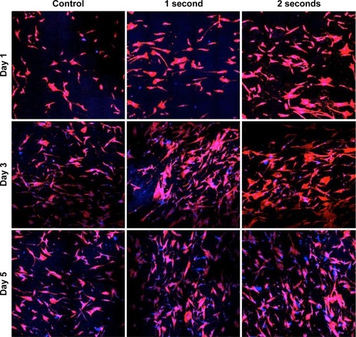 Figure 8 Typical MSC-spreading morphologies (confocal microscopy images, 20× magnification, images are ~1 mm2) after 1 day, 3 days, and 5 days proliferation on: the Ti control, the 1 second plasma-coated Ti, and the 2 seconds plasma-coated Ti samples.Notes: Blue color represents nuclei stained by DAPI; red color represents cytoskeleton stained by Rhodamine-Phalloidin.Abbreviations: MSC, mesenchymal stem cell; DAPI, 4′,6-diamidino-2-phenylindole dihydrochloride.